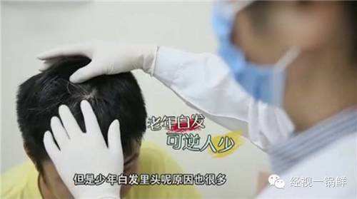 「少年白发怎么办」头发少年白怎么办