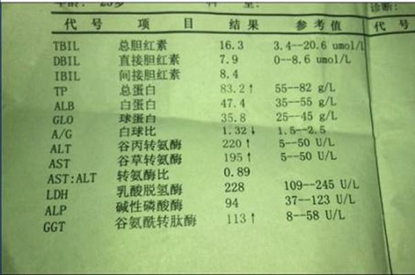 「转氨酶高怎么办」身体转氨酶高怎么办